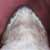 adult, drawing of the throat.